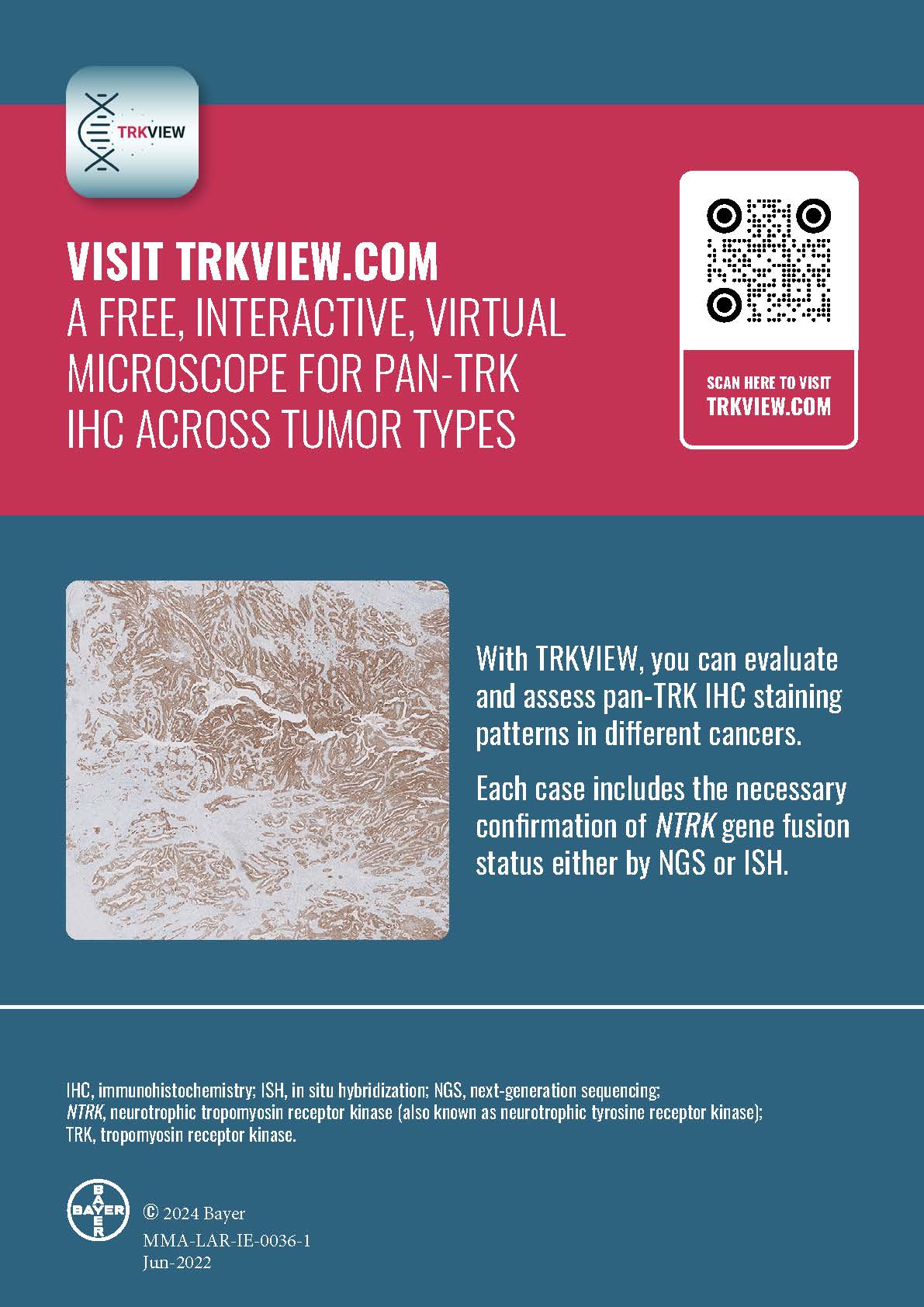 Visit TRKVIEW.COM